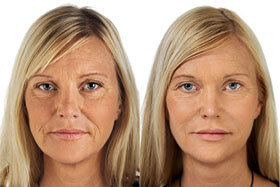 Photo 2 before and after application of Goji Cream