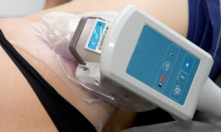 cryolipolysis for the skin of the body